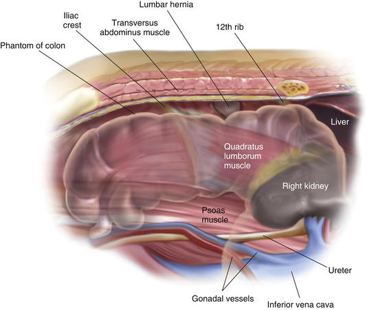 Laparoscopic Repair Of Atypical Hernias Suprapubic Subxiphoid And