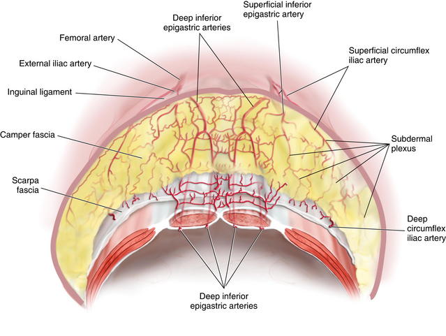 Panniculectomy and Abdominal Wall Reconstruction | Plastic ...