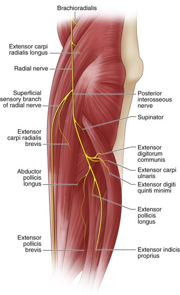 20: Tendon Transfers for Radial Nerve Palsy | Plastic Surgery Key