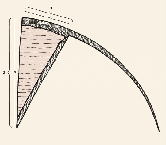 base curve radius conversion