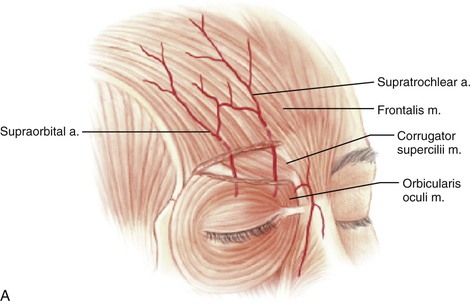 supratrochlear artery