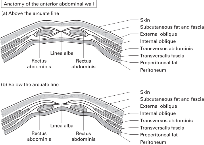 Two diagrams illustrating the anatomy of anterior abdominal wall. Two sheaths of rectus abdominis muscle reveal the structures above the arcuate line and below the arcuate line.