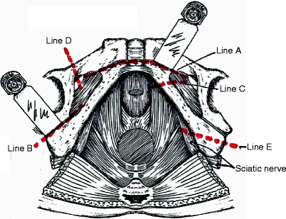 A139176_1_En_11_Fig3_HTML.gif