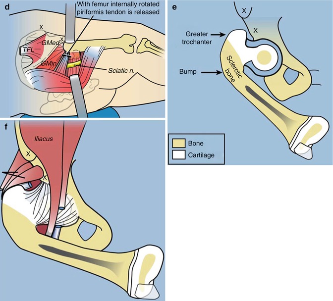 A217604_1_En_13_Fig3b_HTML.jpg