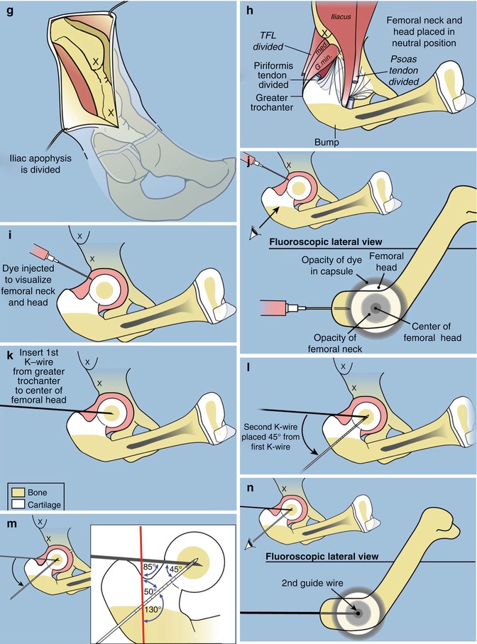 A217604_1_En_13_Fig3c_HTML.jpg