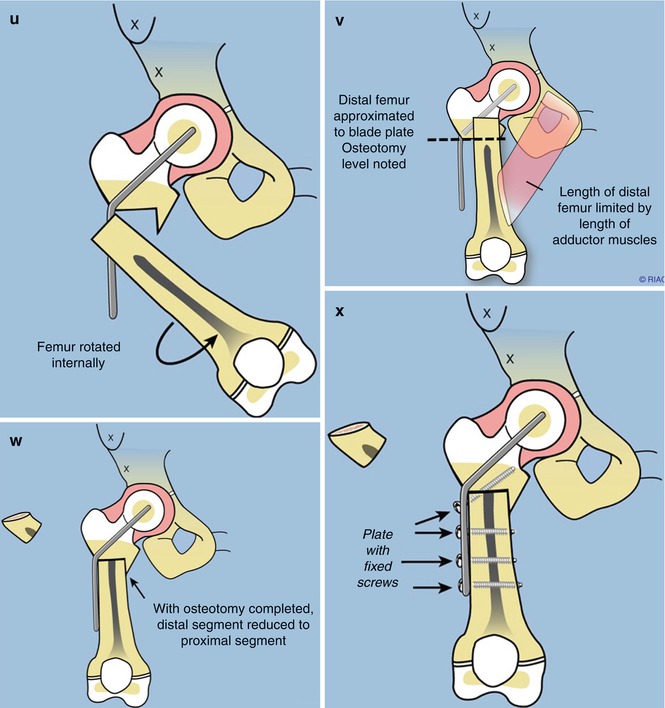 A217604_1_En_13_Fig3e_HTML.jpg