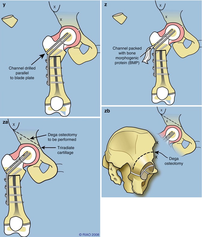 A217604_1_En_13_Fig3f_HTML.jpg