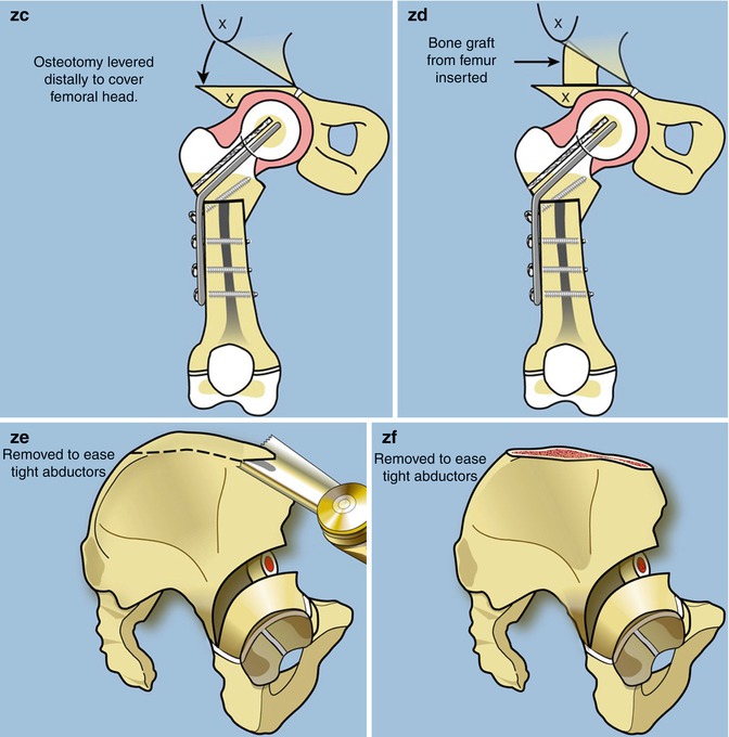 A217604_1_En_13_Fig3g_HTML.jpg