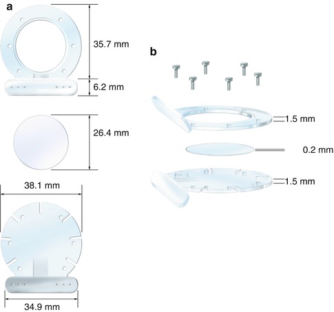 A313287_1_En_15_Fig1_HTML.jpg