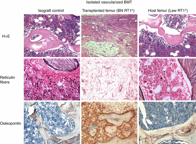 Cellular Therapies Via Vascularized Bone Marrow Transplantation ...