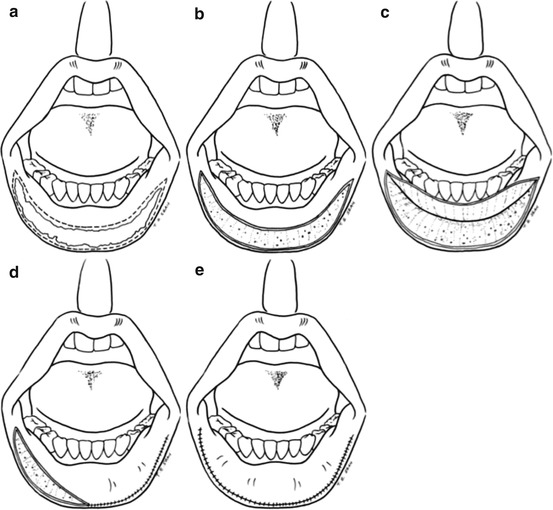 A320996_1_En_11_Fig7_HTML.jpg