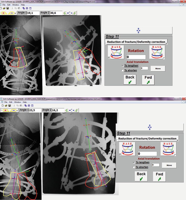 A337458_1_En_158_Fig3_HTML.jpg