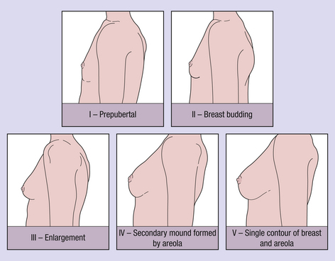 Breast Development During Puberty: Stages and Symptoms