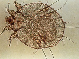 Scabies Mite Eggs Pictures