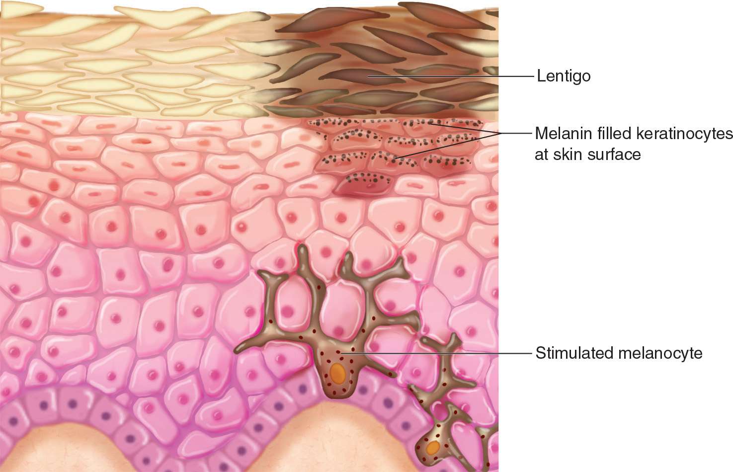 Меланоциты эпидермиса кожи