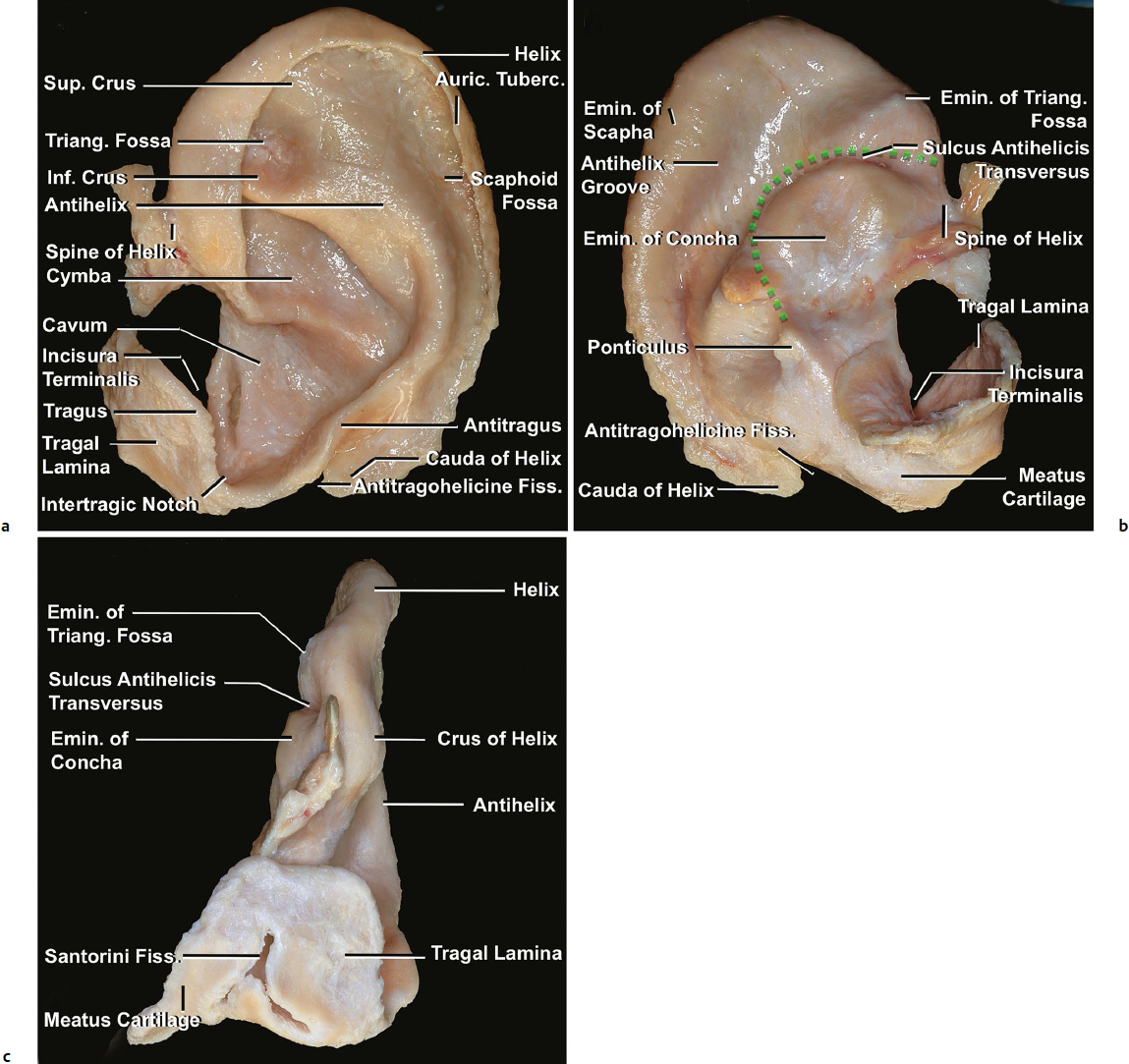 acoustic meatus