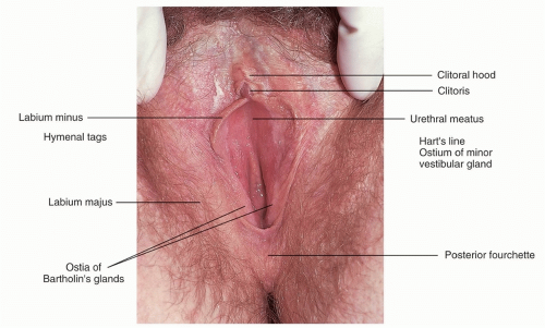 Diversity of vaginal microbiota in sub