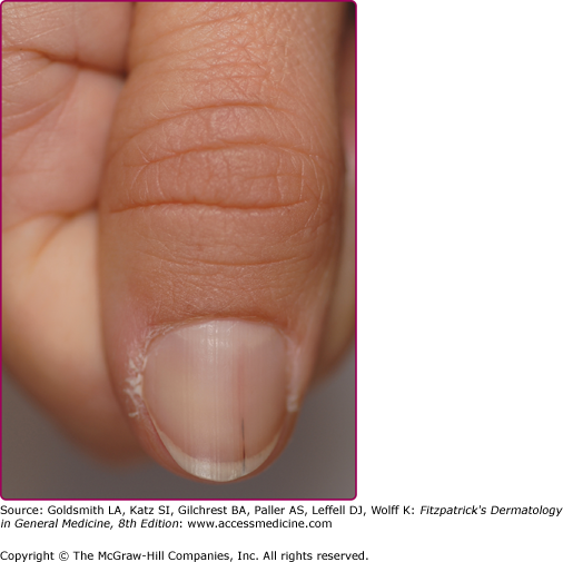 Biology Of Nails And Nail Disorders Plastic Surgery Key