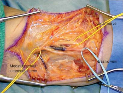 brachial fascia