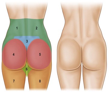 Gluteal Aesthetic Unit Classification