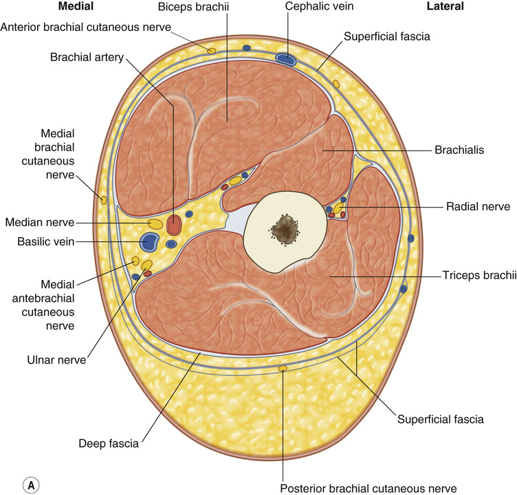 Body Contouring and Suction-Assisted Lipectomy | Plastic Surgery Key