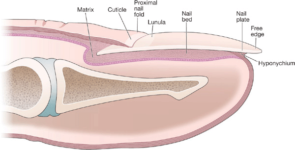 Type II deformity: exostosis is distal to the nail plate. The nail... |  Download Scientific Diagram