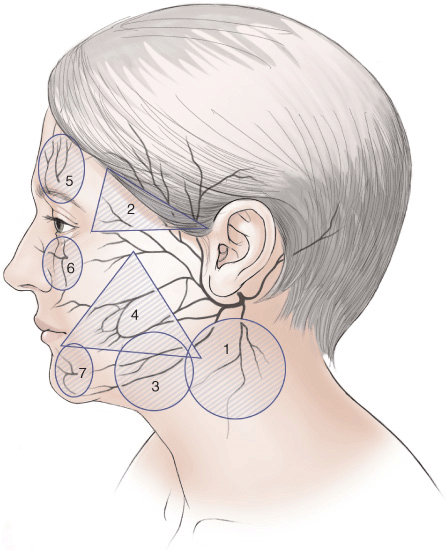 Зона висков. Иглотерапия лицевого нерва. Лицевой нерв зона. Лицевой нерв в сосцевидном отростке.