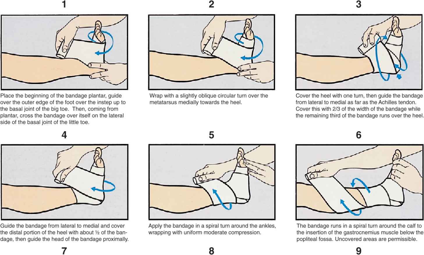 What Do Compression Bandages Look Like at Kathryn Nash blog