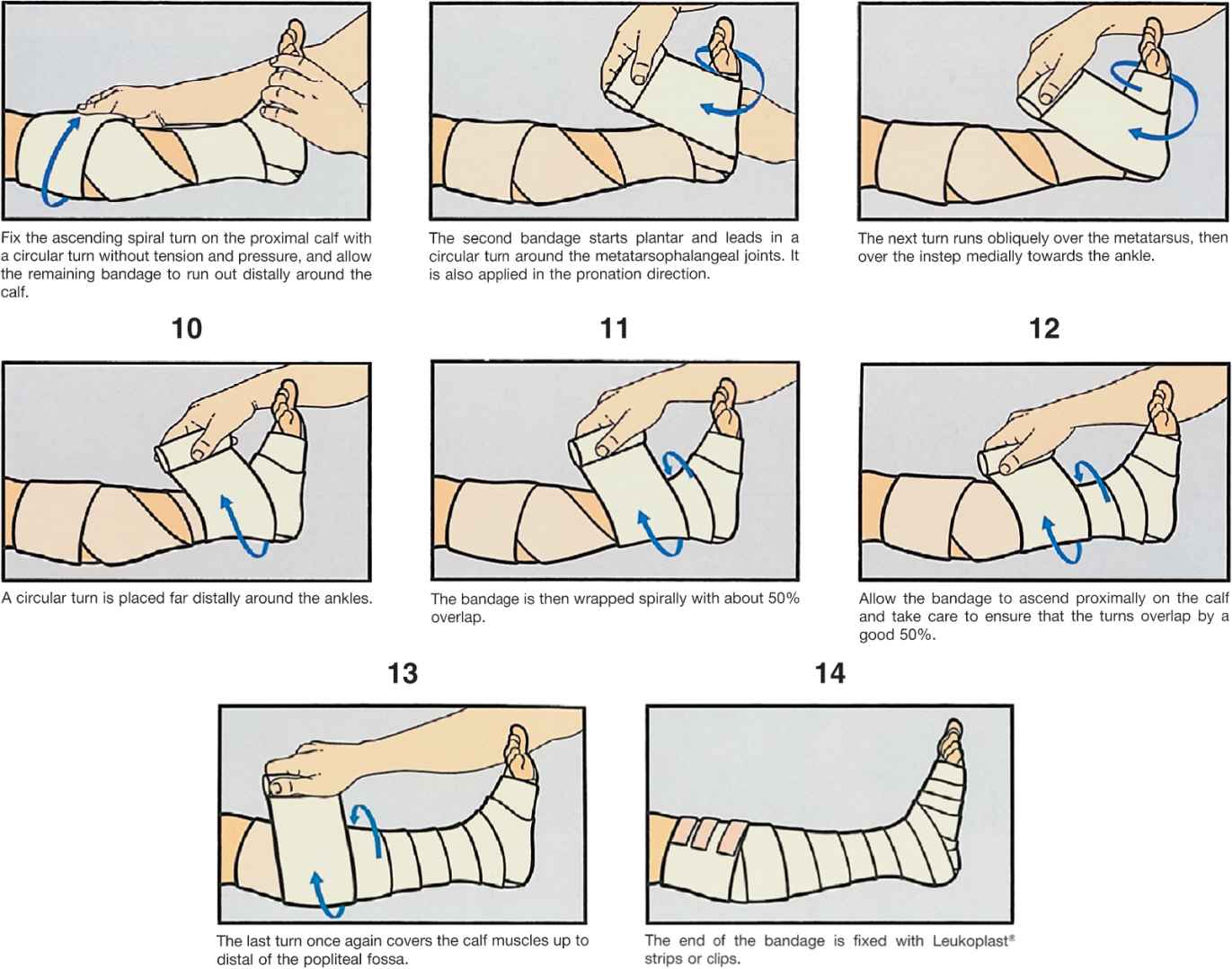 how-to-use-crepe-bandage-on-leg-at-rafael-flowers-blog