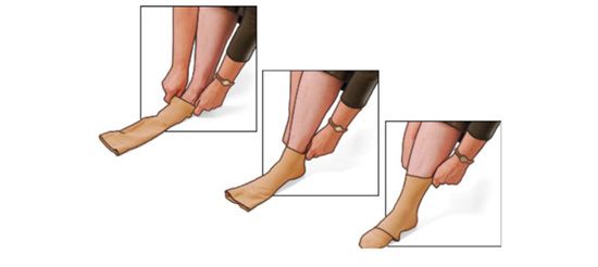 Comprezon - Comprezon Varicose Vein Stockings is designed to provide  consistent and graduated pressure in the legs, helping blood to flow back  toward the heart. Comprezon is manufactured following tremendous research  and