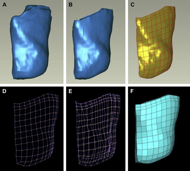 3D Mechanical Modeling of Facial Soft Tissue for Surgery