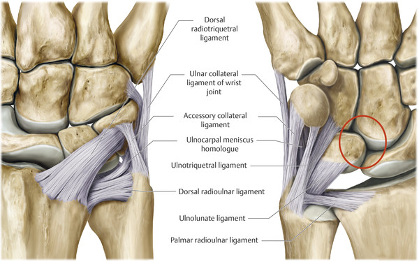 radiate ligament wrist