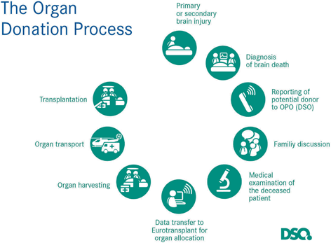 Organ Donation And Transplantation In Germany | Plastic Surgery Key