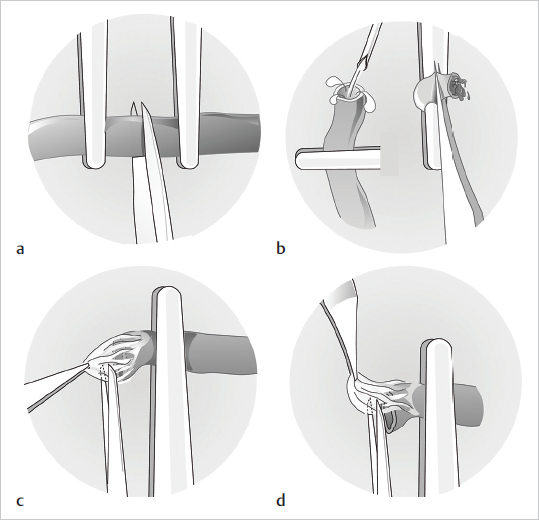 Microsurgery | Plastic Surgery Key