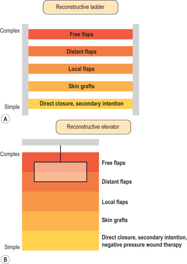 Lower Extremity Reconstruction | Plastic Surgery Key