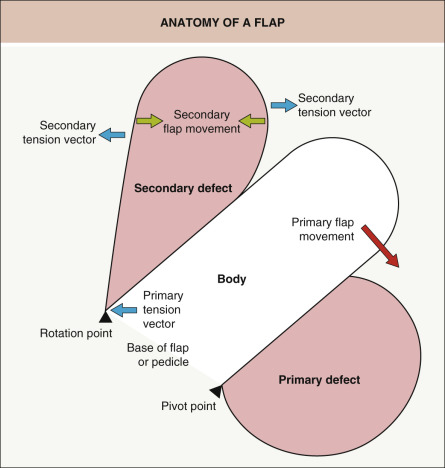 Flaps | Plastic Surgery Key