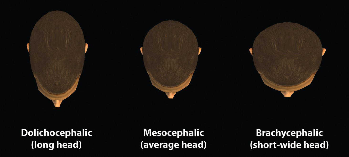 Three models of head shapes viewed from above: Dolichocephalic (long head), Mesocephalic (average head), and Brachycephalic (short-wide head). Each shape is labeled accordingly.
