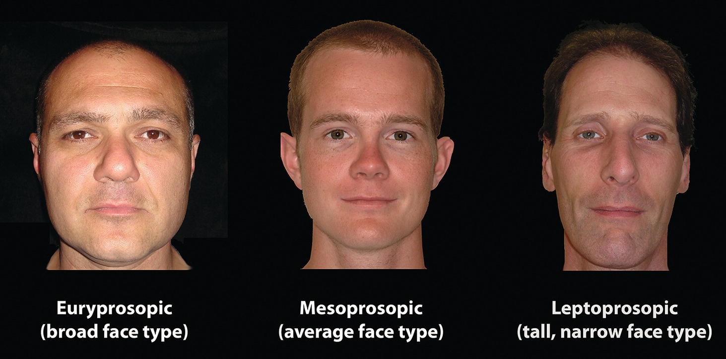 Three facial types displayed: Euryprosopic (broad face), Mesoprosopic (average face), and Leptoprosopic (tall, narrow face). Each face type is labeled beneath the corresponding image.