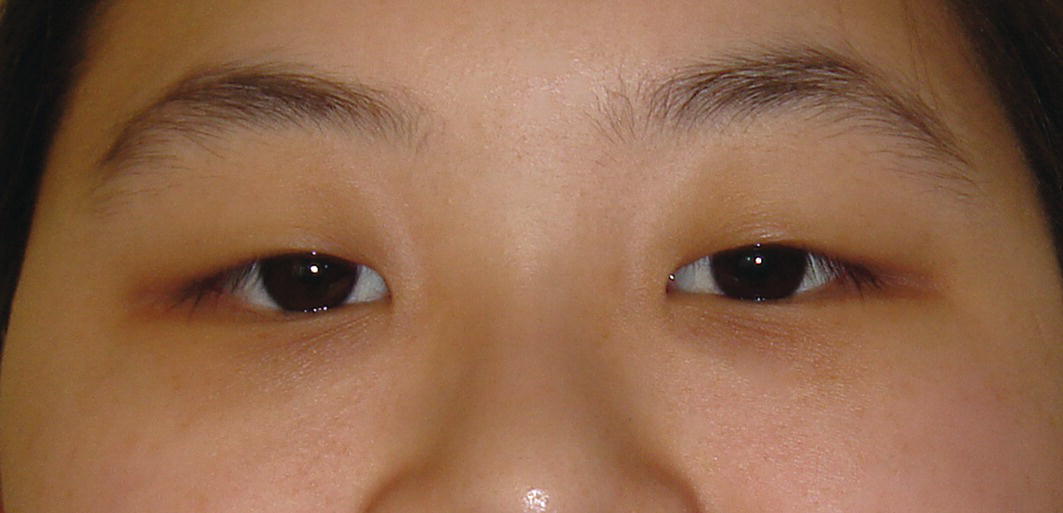 A closer view of a woman's face focusing on her eyes, showing natural skin tone and eyebrow shape.