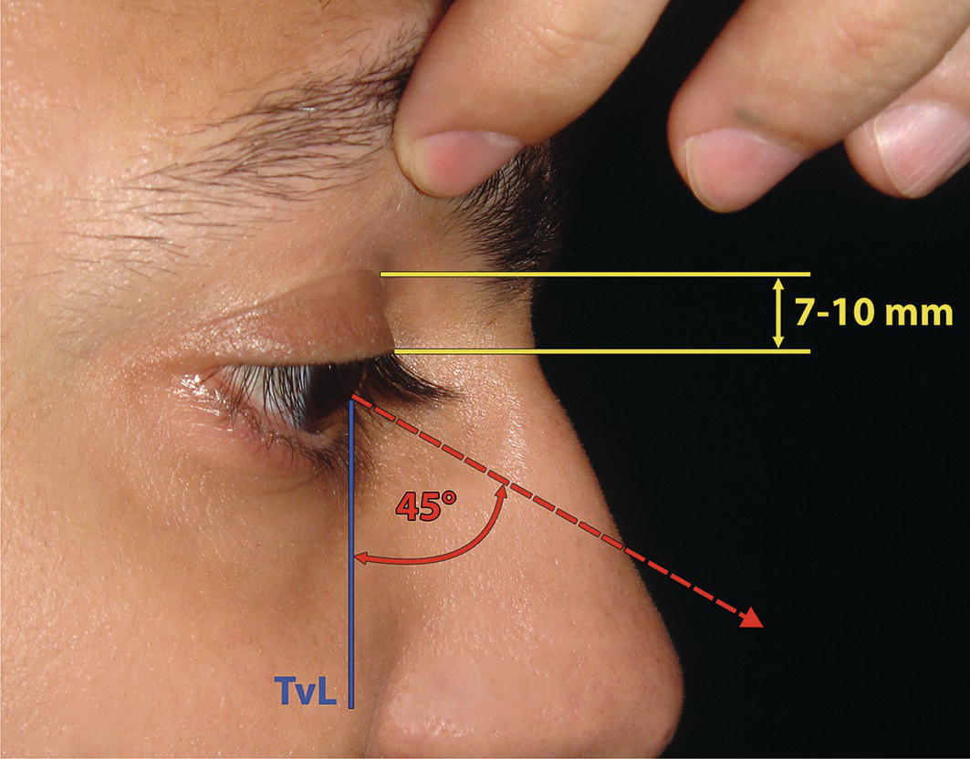 A photograph shows a side profile of a man's eye, with a hand holding his eyelid and measurement lines indicating eye dimensions. An angle of 45 degrees is marked to illustrate the positioning in relation to the eye.