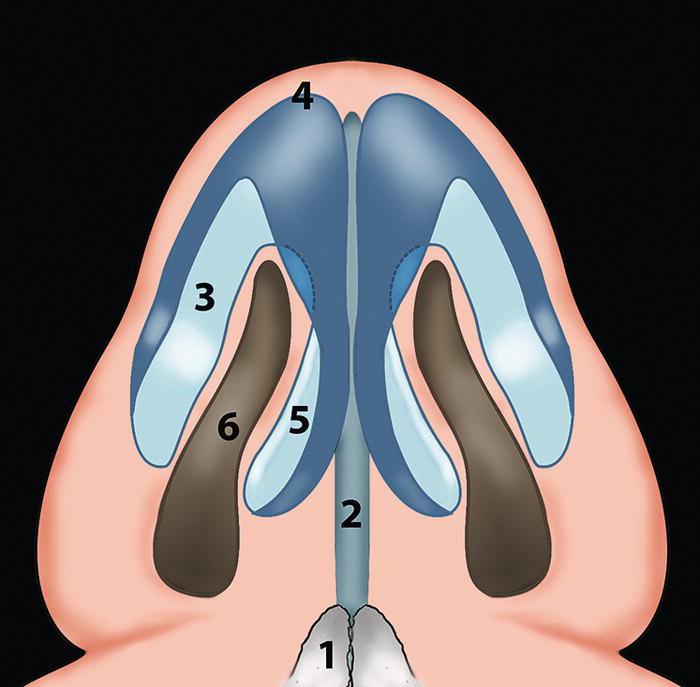 A top-down view of the nasal cavity with anatomical labels numbered from 1 to 6, where different colors represent various structures.