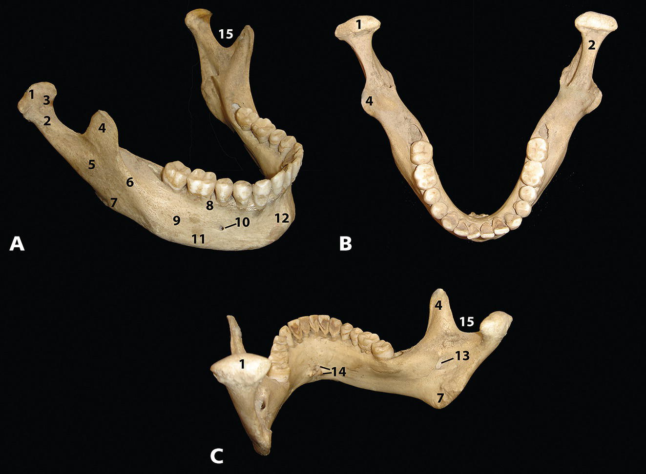 An image of human skull teeth from the right side indicates the ramus and alveolar process structures.
