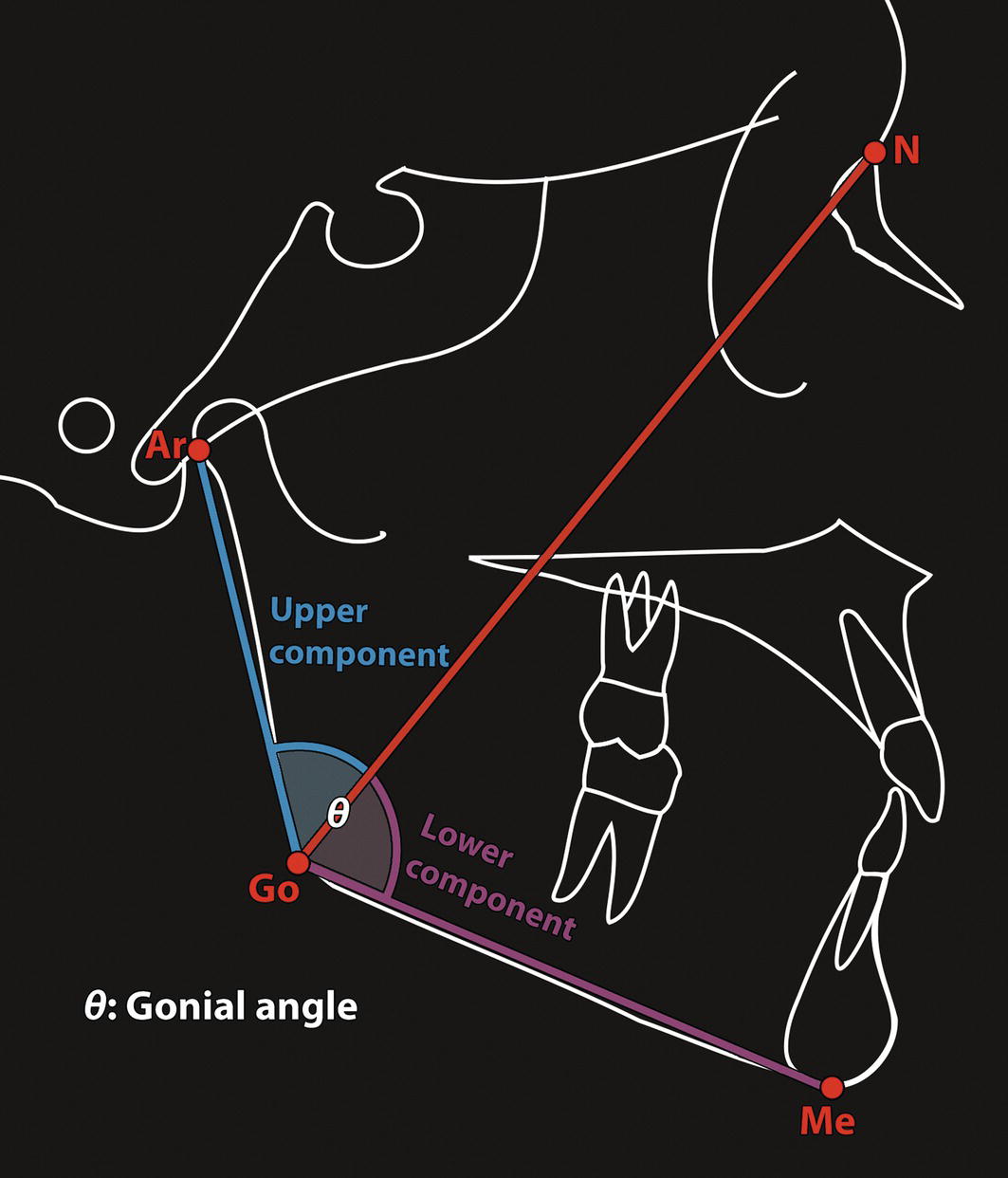An image of the gonial angle indicates its upper and lower sections for analyzing mandible inclination.