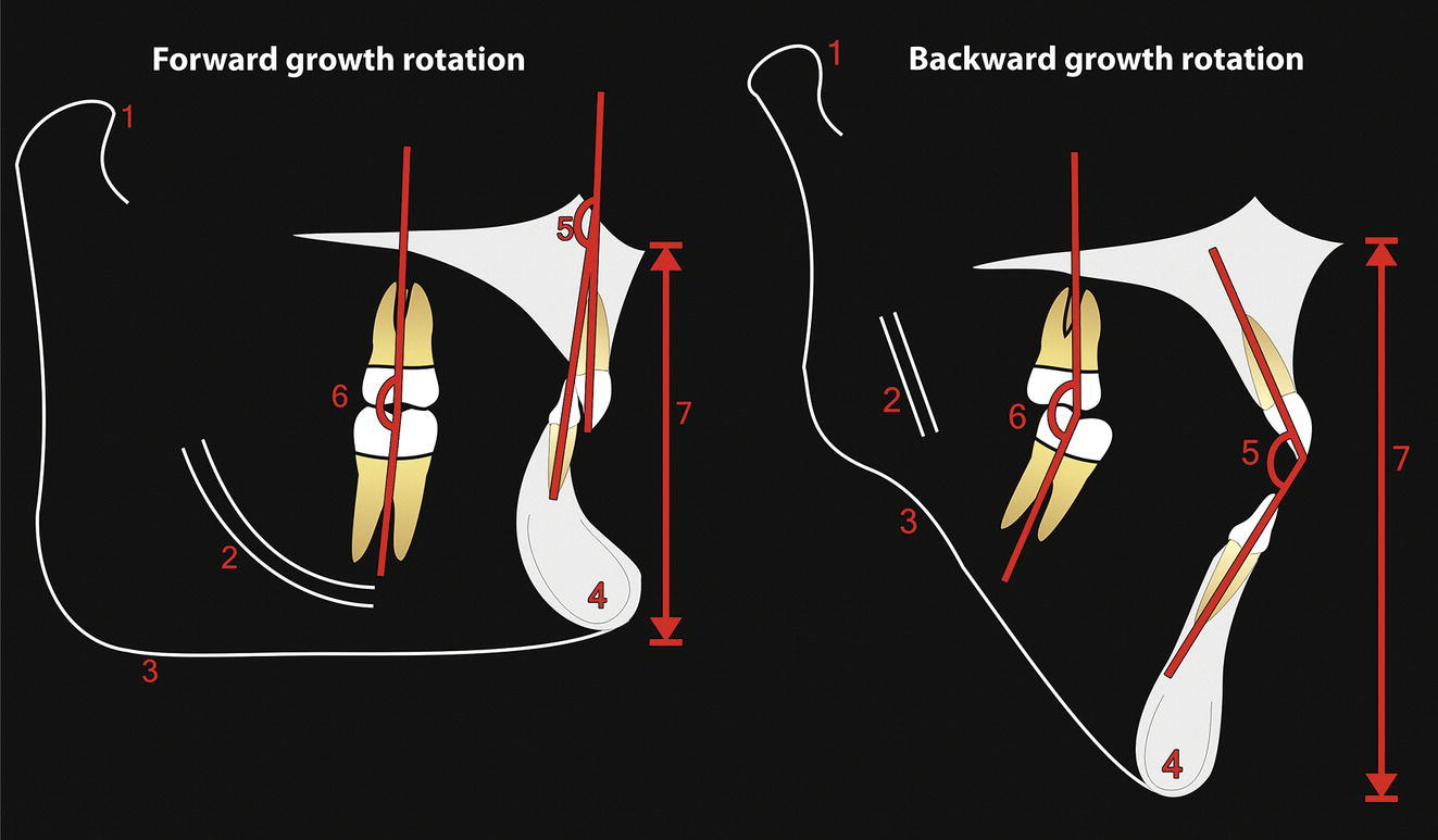 An image of Bjork's seven structural signs indicates mandibular growth patterns for orthodontic analysis.