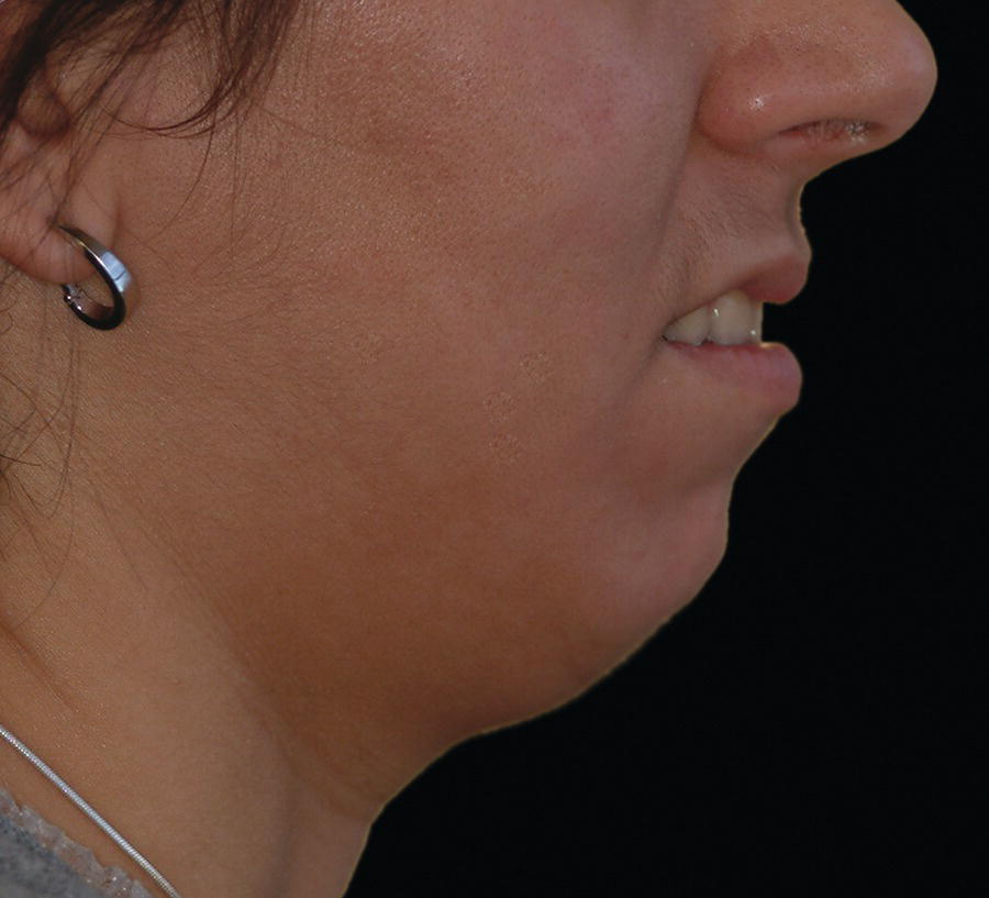 An image of the inferior border of the mandible indicates the indistinct outline of the jaw's lower section.