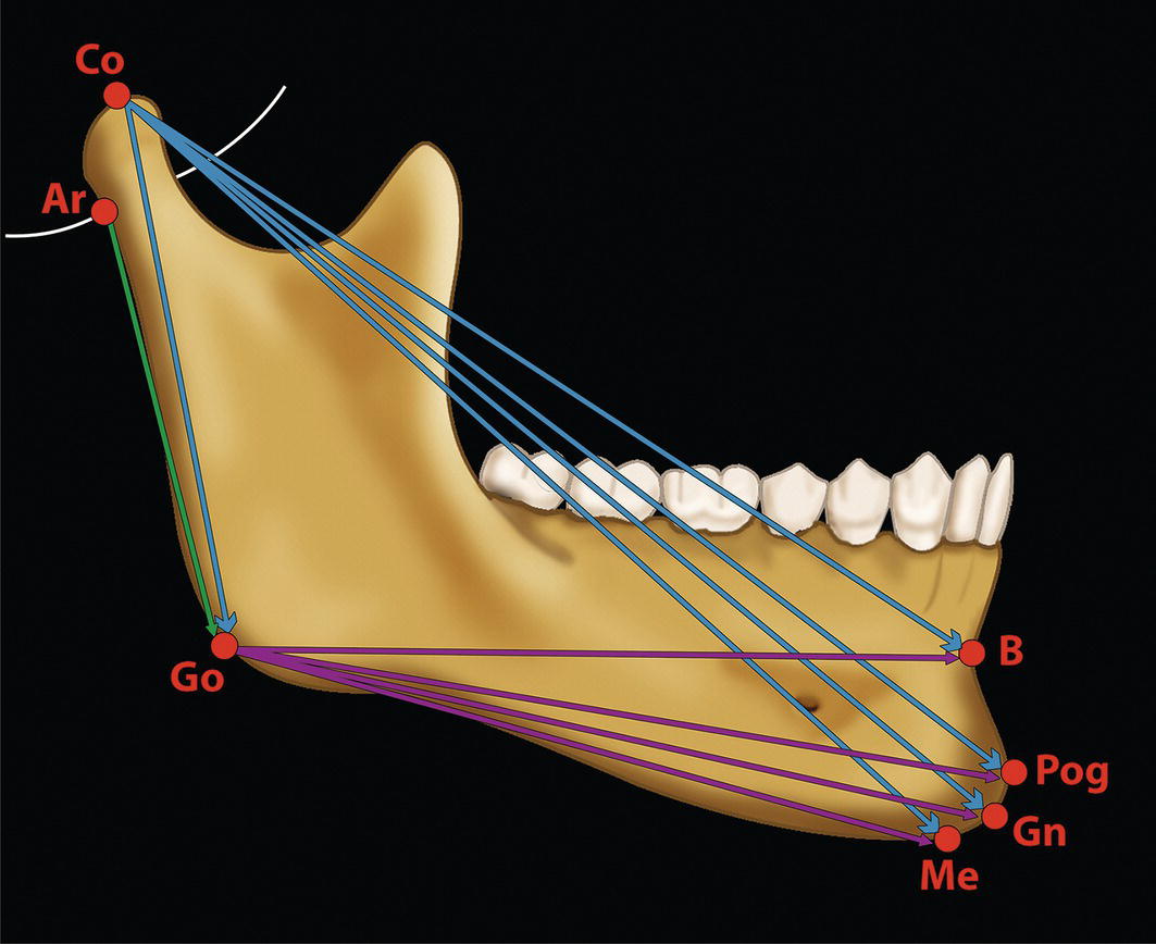 An image of the jaw including major bones and muscle structures for anatomical.
