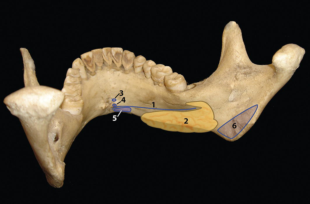 A diagram showing the submental anatomy in relation to the mandible, with muscle attachments labelled. The diagram shows the mandible with the teeth and the surrounding muscles that attach to it. The muscles shown are the mylohyoid muscle, submandibular salivary gland, genioglossus muscle, geniohyoid muscle, anterior belly of digastric muscle, and medial pterygoid muscle.