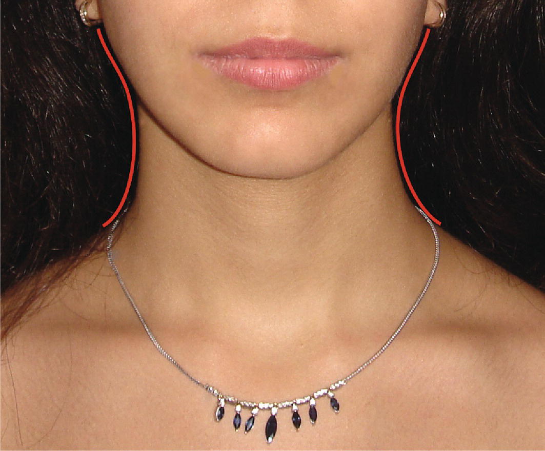 A photograph of a person is depicted wearing a necklace, showcasing a subtle hourglass appearance in the transition from the upper neck to the lower jaw. The image emphasizes various fashion accessories, including earrings and body jewellery.