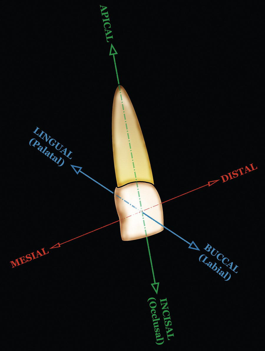 A photograph of tooth crown surfaces and directions of tooth movement. It is labelled as lingual, distal, medial, and buccal.