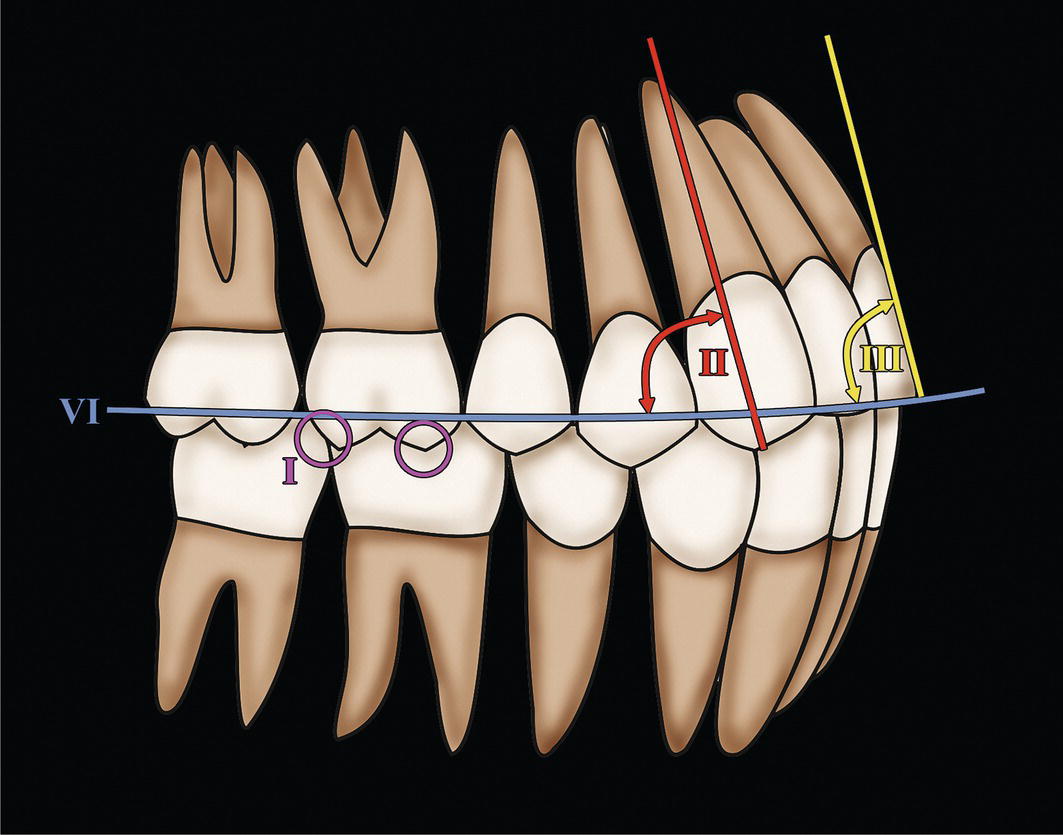 A diagrammatic representation of teeth. It depicts the side view of molar, premolar, and canine teeth.